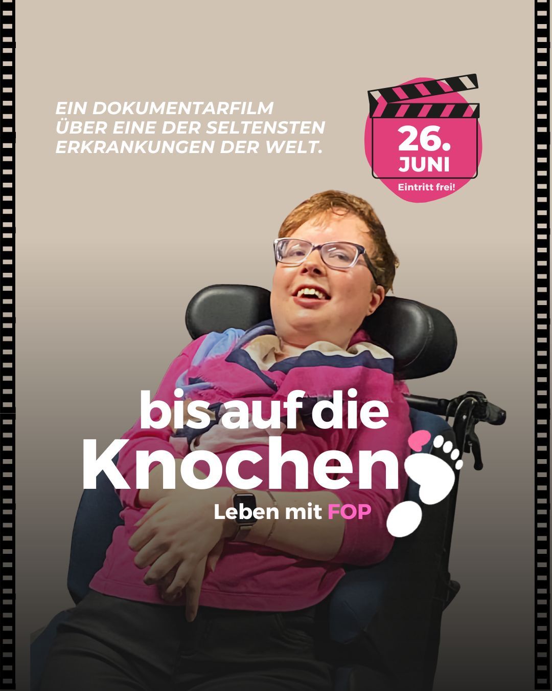 Leben mit FOP - 1 Leben mit FOP - 1